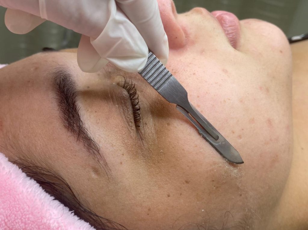 Dermaplaning: Engrossa os pelos? – Site Empresa